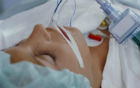 Coma